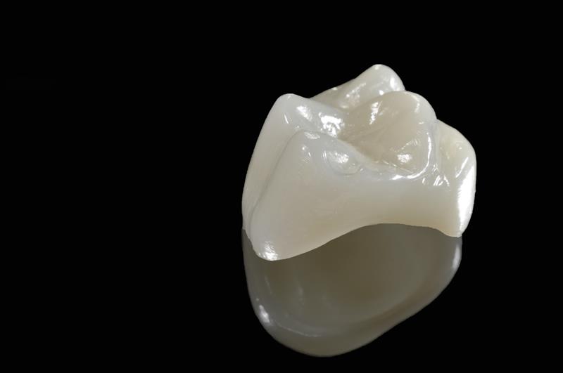 Porcelain Crowns Hickory, NC 